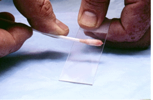 Picture 2 : ภาพแสดงการ Smear ตัวอย่างที่เก็บได้บนสไลด์ก่อนย้อมสีและส่องตรวจ (www.vetmed.lsu.edu)